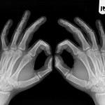 1319307_xray